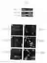Fig. 13 - Neural precursor cells produced from bone marrow stromal cells containing an exogenous nucleic acid encoding a notch intracellular domain (NICD)