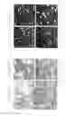 Fig. 16 - Neural precursor cells produced from bone marrow stromal cells containing an exogenous nucleic acid encoding a notch intracellular domain (NICD)