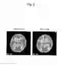 Fig. 06 - MEANS AND METHODS FOR ACTIVATING VAGUS NERVE