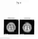 Fig. 07 - MEANS AND METHODS FOR ACTIVATING VAGUS NERVE