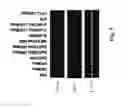 Fig. 06 - Method of treating inflammatory lung disease with suppressors of CpG oligonucleotides