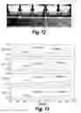 Fig. 08 - Methods and compositions for CNS delivery of arylsulfatase A