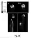 Fig. 37 - Methods and compositions for CNS delivery of arylsulfatase A