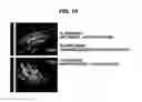 Fig. 02 - Pre-ligand assembly domain of the IL-17 receptor