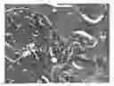 Fig. 01 - METHODS OF TREATING BONE-LOSS DISORDERS USING A GM-CSF ANTAGONIST