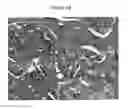 Fig. 08 - METHODS OF TREATING BONE-LOSS DISORDERS USING A GM-CSF ANTAGONIST