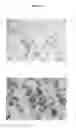 Fig. 17 - Method of treating cancer and/or cellular proliferative conditions and agents targeting hyaluronan anabolism useful for same