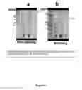 Fig. 28 - Method of treating cancer and/or cellular proliferative conditions and agents targeting hyaluronan anabolism useful for same