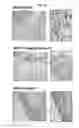 Fig. 13 - Antibodies to endoplasmin and their use