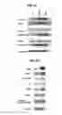 Fig. 20 - Antibodies to endoplasmin and their use