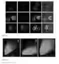 Fig. 03 - USE OF MEMBRANE ATTACK COMPLEX (MAC) AND IMMUNE COMPLEXES (ICs) TO ACTIVATE T-CELLS AND THE GENERATION OF REGULATORY T CELLS
