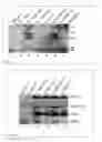 Fig. 05 - USE OF MEMBRANE ATTACK COMPLEX (MAC) AND IMMUNE COMPLEXES (ICs) TO ACTIVATE T-CELLS AND THE GENERATION OF REGULATORY T CELLS