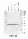 Fig. 15 - Hypallergenic mosaic antigens and methods of making same