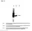 Fig. 03 - Meningococcal And Pneumococcal Conjugate Vaccine And Method Of Using Same