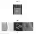 Fig. 02 - BLOOD COAGULATION INDUCING POLYMER HYDROGEL