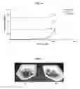 Fig. 06 - BLOOD COAGULATION INDUCING POLYMER HYDROGEL