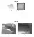 Fig. 07 - BLOOD COAGULATION INDUCING POLYMER HYDROGEL