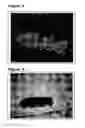 Fig. 04 - Treatment methods using a particulate cadaveric allogenic juvenile cartilage particles