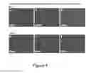 Fig. 05 - METHOD OF DISEASE-INDUCED AND RECEPTOR-MEDIATED STEM CELL NEUROPROTECTION
