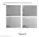 Fig. 07 - METHOD OF DISEASE-INDUCED AND RECEPTOR-MEDIATED STEM CELL NEUROPROTECTION