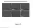Fig. 11 - METHOD OF DISEASE-INDUCED AND RECEPTOR-MEDIATED STEM CELL NEUROPROTECTION