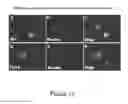 Fig. 13 - METHOD OF DISEASE-INDUCED AND RECEPTOR-MEDIATED STEM CELL NEUROPROTECTION