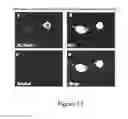 Fig. 14 - METHOD OF DISEASE-INDUCED AND RECEPTOR-MEDIATED STEM CELL NEUROPROTECTION