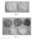 Fig. 03 - MICROWAVABLE FROZEN COOKIE DOUGH