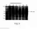 Fig. 07 - Recombinant polypeptide having pancreatic lipase activity and nucleic acid coding sequence thereof, and their production and use