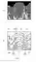 Fig. 06 - Electrolyte and secondary battery