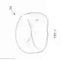 Fig. 02 - Orthodontic Appliance