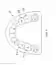Fig. 06 - Orthodontic Appliance