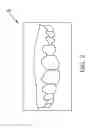 Fig. 09 - Orthodontic Appliance