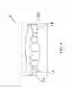 Fig. 10 - Orthodontic Appliance