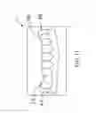 Fig. 12 - Orthodontic Appliance
