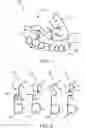 Fig. 02 - APPARATUS, SYSTEM, AND METHOD FOR REMOVAL OF DENTAL PROSTHESIS
