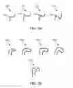 Fig. 03 - APPARATUS, SYSTEM, AND METHOD FOR REMOVAL OF DENTAL PROSTHESIS