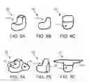 Fig. 06 - APPARATUS, SYSTEM, AND METHOD FOR REMOVAL OF DENTAL PROSTHESIS