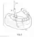 Fig. 05 - GUIDE PIN FOR DENTAL IMPLANTATION