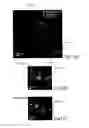 Fig. 16 - SUB-DIFFRACTION IMAGE RESOLUTION AND OTHER IMAGING TECHNIQUES