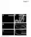 Fig. 07 - DEVICE AND NON-TOXIC COMPOSITIONS AND METHODS FOR PERMEABILIZATION OF DROSOPHILA EMBRYOS