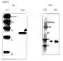 Fig. 03 - Method for measuring β-glucan, and β-glucan-binding protein for use in the method