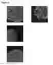 Fig. 03 - METHODS AND COMPOSITIONS FOR REPROGRAMMING CELLS