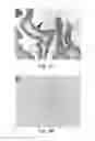 Fig. 03 - Reagents and Methods for Assessment of Human Tumor Malignancy and for Targeting Malignant Tumor Cells