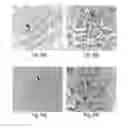 Fig. 05 - Reagents and Methods for Assessment of Human Tumor Malignancy and for Targeting Malignant Tumor Cells