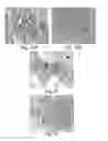 Fig. 09 - Reagents and Methods for Assessment of Human Tumor Malignancy and for Targeting Malignant Tumor Cells