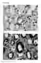 Fig. 04 - Peptide biomarkers predictive of renal function decline and kidney disease