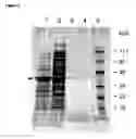 Fig. 06 - PROTEIN PARTICLES