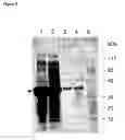 Fig. 07 - PROTEIN PARTICLES