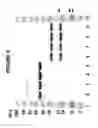 Fig. 05 - Compositions, methods and kits for preparing plasminogen and plasmin prepared therefrom